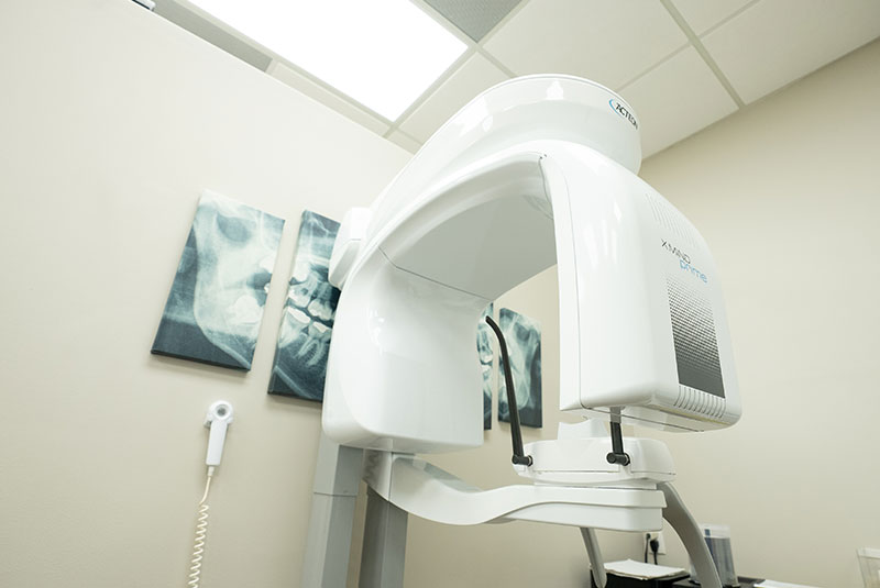 cbct