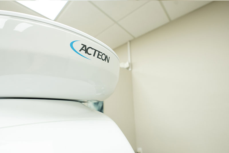 acteon machine