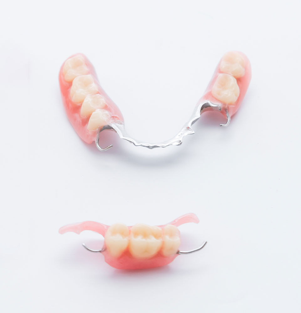 Partial Dentures Solution
