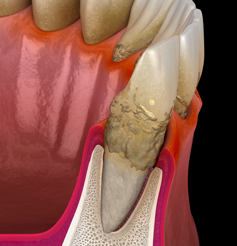 Gum Health Anatomy