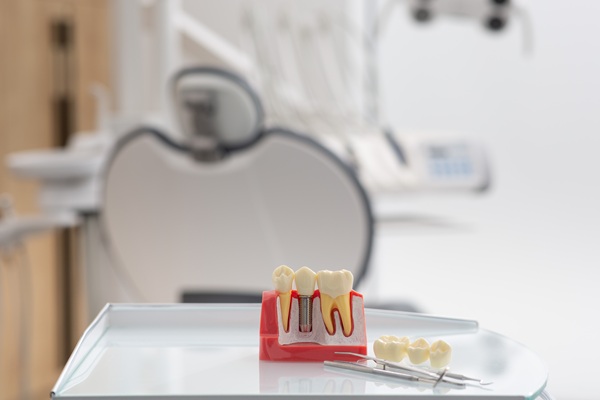 How To Know You Are A Candidate For Dental Implants